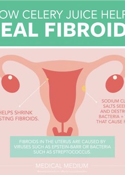 How Celery Juice Helps Heal Fibroids 