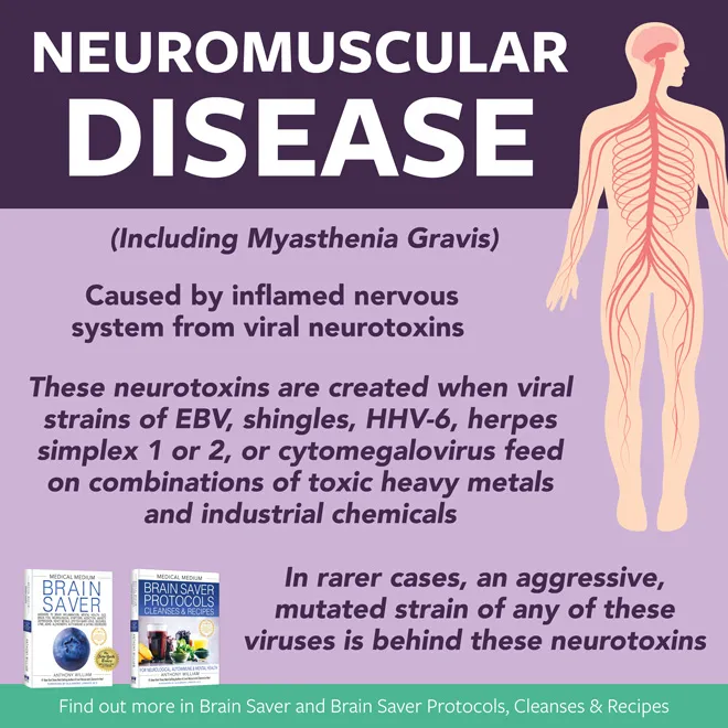 Neuromuscular Disease (Including Myasthenia Gravis)