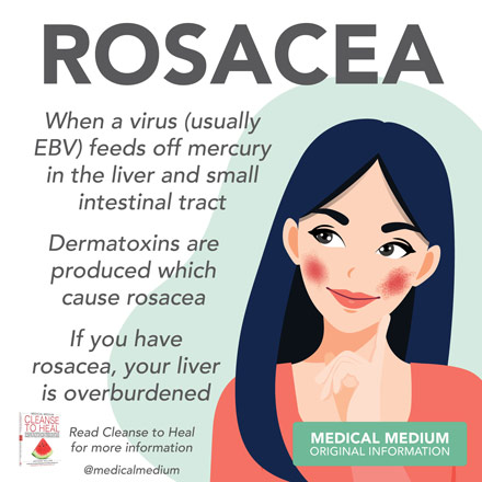 Rosacea